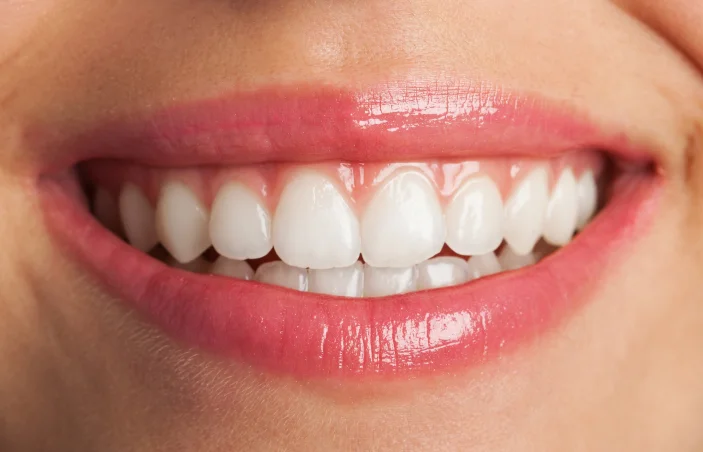 teeth whitening abu dhabi