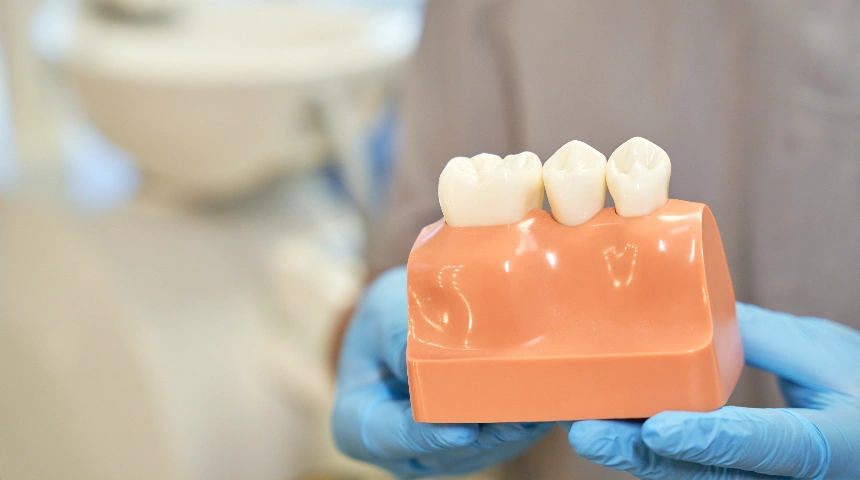 Dental Crown & Bridge